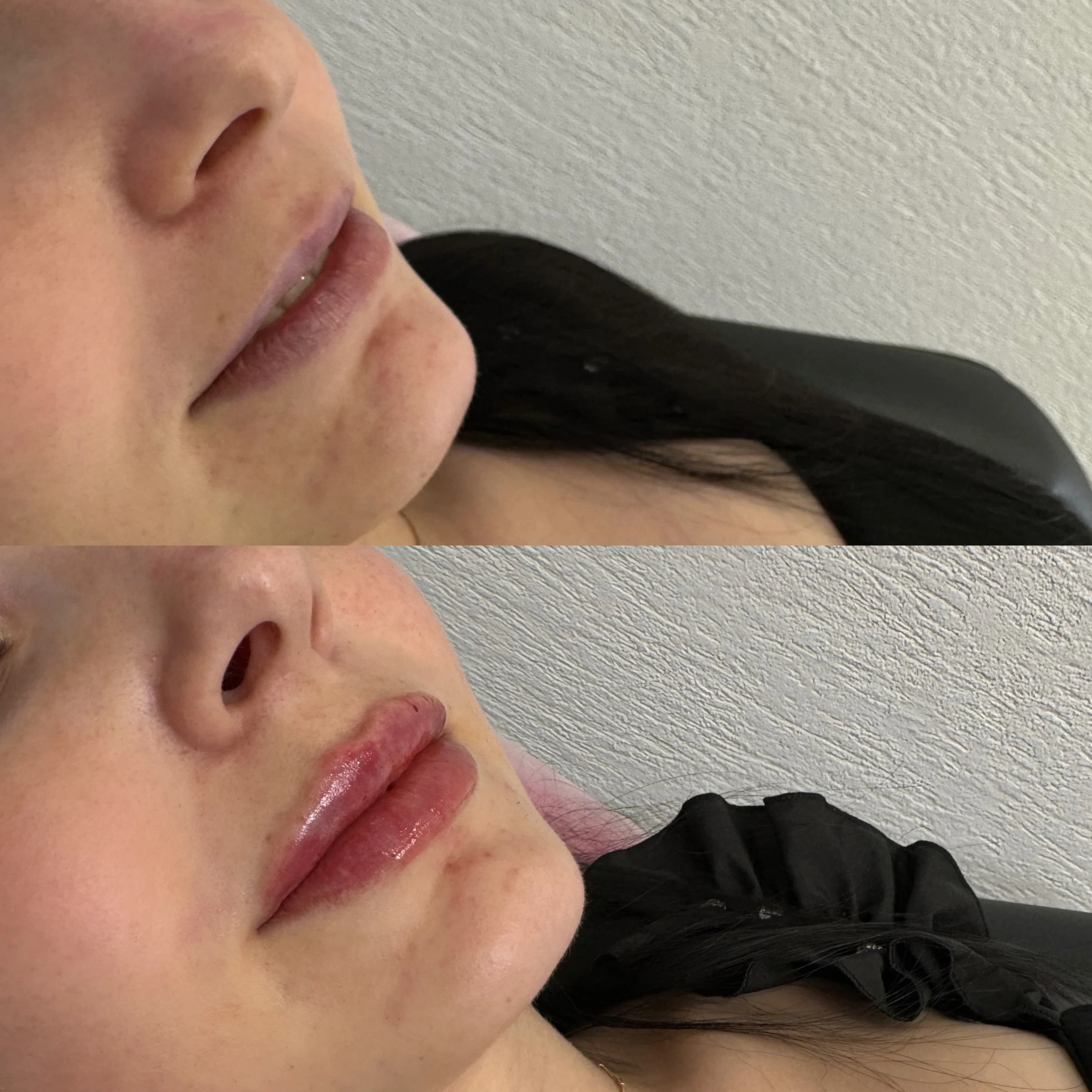 lips